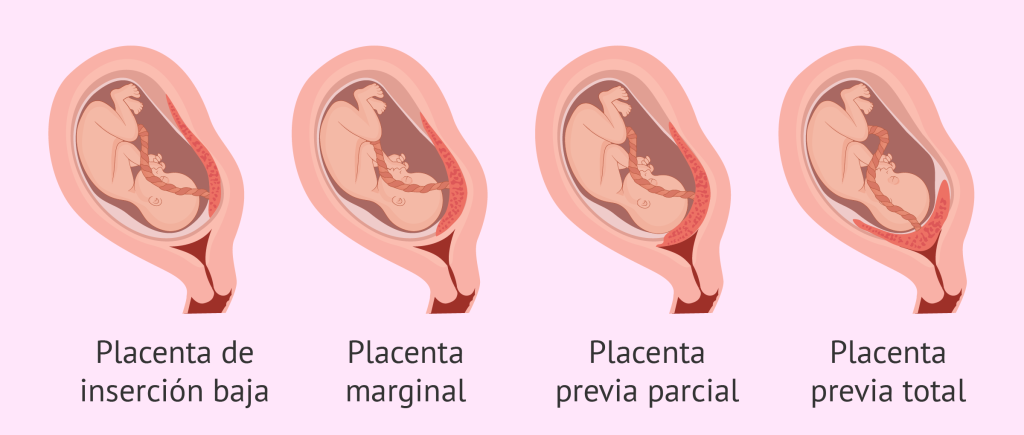 Los distintos tipos de placenta: características y funciones